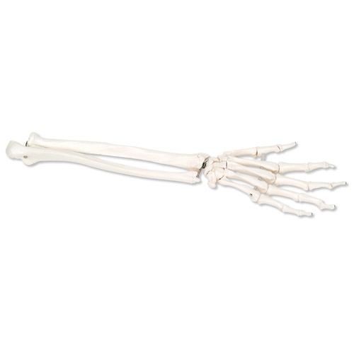 手骨骼(带有部分尺骨和桡骨)灵活移动连接(左)