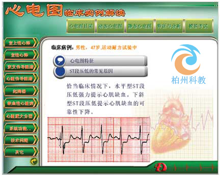 新版心电图教学软件