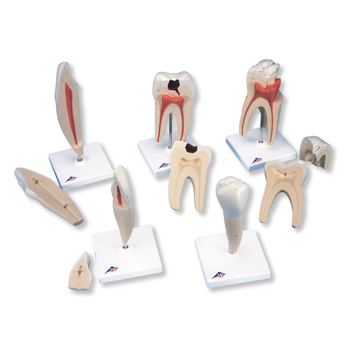 进口经典牙齿模型系列(5种模型)-德国3B-D10