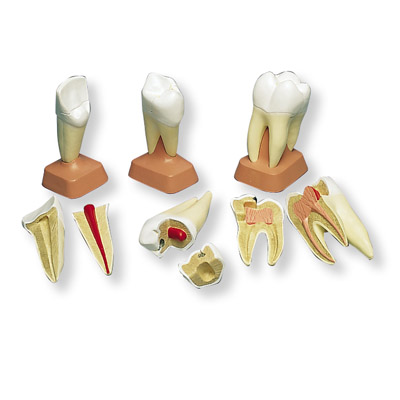 进口上颌三根龋臼齿模型(2部分)-德国3B-VE298