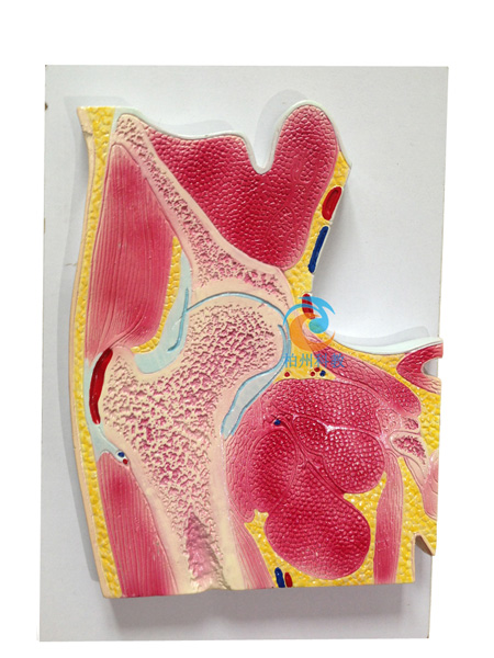 髋关节剖面模型