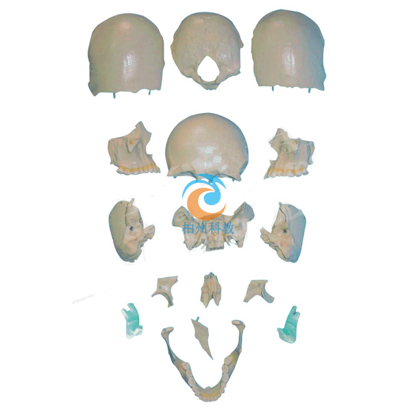 部分颅骨散骨模型